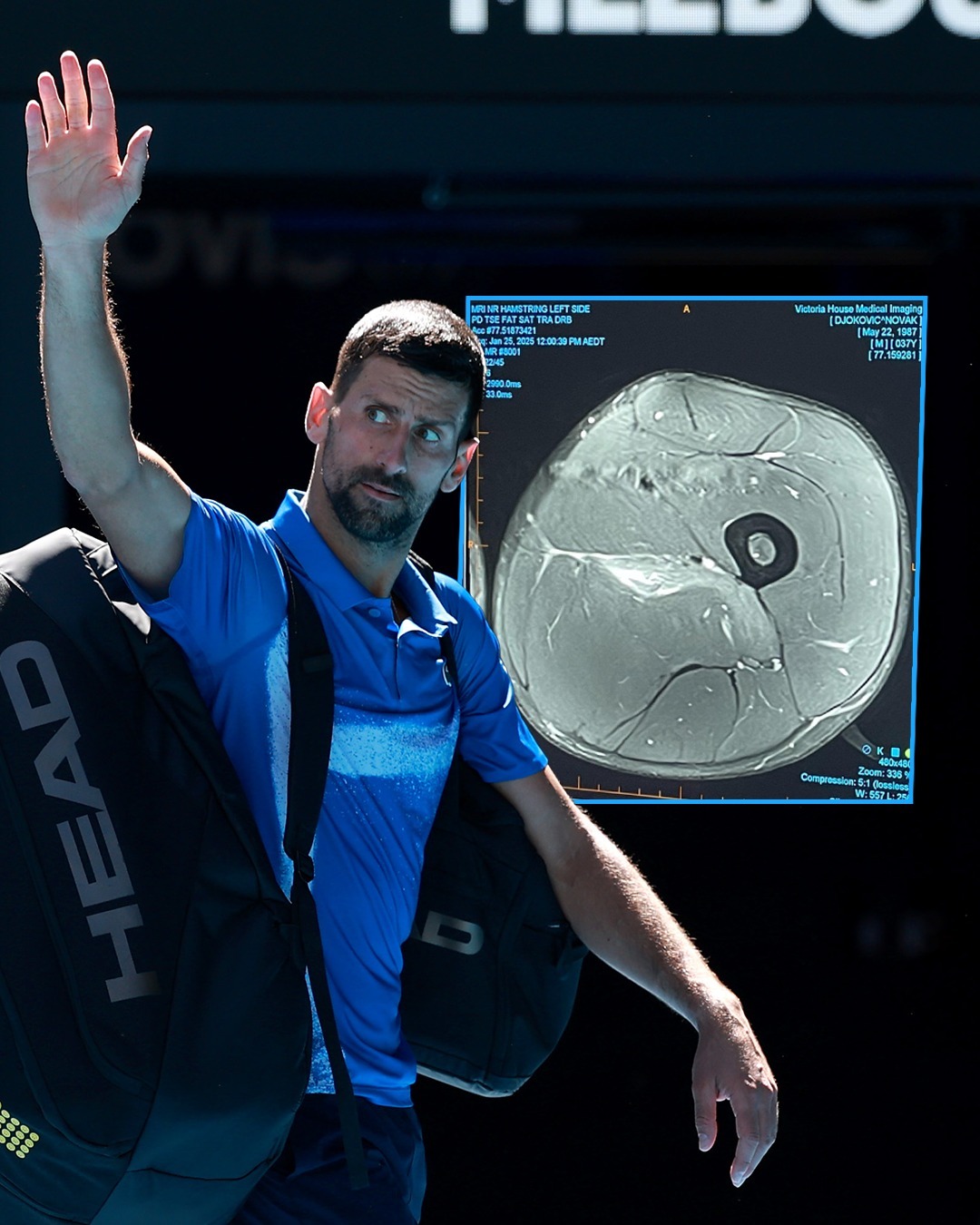 澳大利亚网球队逆转日本网球队,德约科维奇绝境逆转的简单介绍 澳大利亚网球队逆转日本网球队,德约科维奇绝境逆转的简单介绍